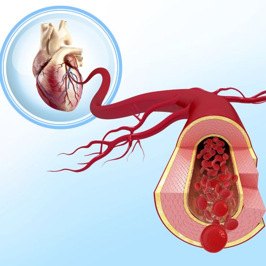 How to Lower Blood Pressure – The Nitric Oxide Effect